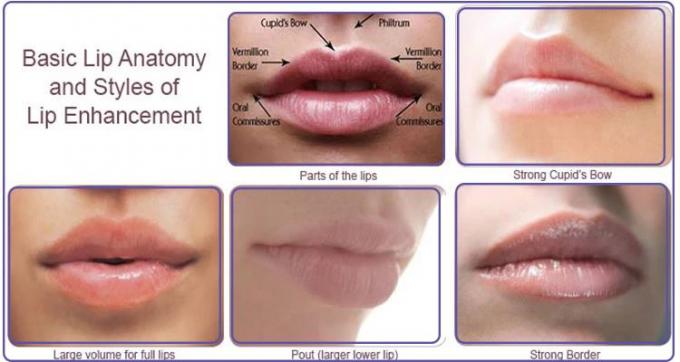 Заполнители губы Насолабял створки мужской женской впрыски губы более пухлые естественные смотря